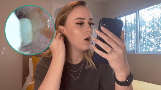 Orynoa NE (Series 7) Earwax Removal Kit in action